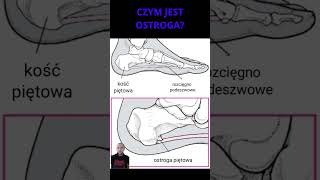 Ostroga piętowa W praktyce anatomia stopa ostroga podeszwa [upl. by Cruz]