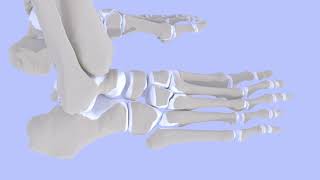 Surgical Management of Fifth Metatarsal Jones Fractures Intramedullary Screw Fixation [upl. by Tennek877]