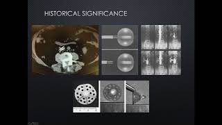 SIRRFS Webinar 8222018 Introduction to IVC Filters  Placement and Retrieval Techniques [upl. by Ilah]