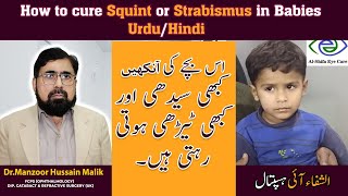 How to cure Squint or Strabismus in Babies  Urdu Hindi [upl. by Karin]