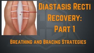 Diastasis Recti Recovery Part 1 Breathing and Bracing Strategies [upl. by Dreeda199]