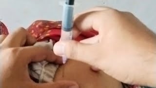 INTRAMUSCULAR INJECTIONS VIDEO PROCEDURE ll INJECTION VIDEO ll BUTTOCKS INJECTION VIDEO FOR WOMEN ll [upl. by Zerelda]