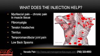 Trigger Point Injections explained by a Las Vegas pain management center [upl. by Lipinski]