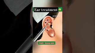 Ear infection treatment calmdown musica youtubeshorts trending [upl. by Cammi632]