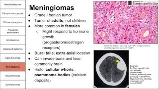 Nervous System Tumors [upl. by Arlie522]