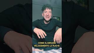 Rughe Come Eliminarle Velocemente  caloironix [upl. by Assilen94]