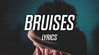 SadBoyProlific  Bruises Lyrics  Lyric Video [upl. by Onaicram]