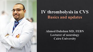 IV thrombolysis in AIS  basics and updates  DrAhmed Dahshan [upl. by Yngad]