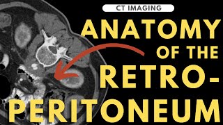 Retroperitoneal anatomy organs and spaces  Radiology anatomy part 1 prep  CT abdomen [upl. by Aisital]