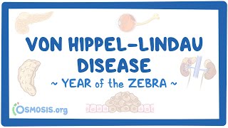 Von HippelLindau disease Year of the Zebra 2024 [upl. by Nomyad]