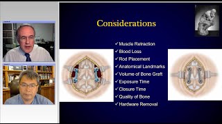 Sagittal Imbalance and Minimally Invasive Spine Surgery Preview [upl. by Semaj128]