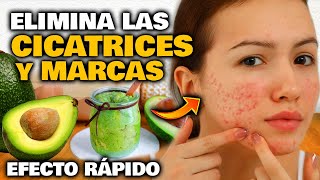 Elimina TODAS las CICATRICES y MARCAS de tu Rostro y tu Piel  Mascarilla y Crema Facial Casera [upl. by O'Shee]