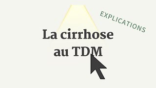 Cirrhose au TDM  Conf Apollon [upl. by Aivlys]