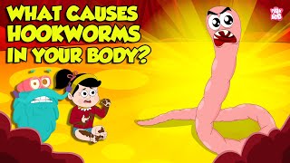 What causes Hookworm। Intestinal Worms Symptoms and Treatment  Worm Infection  Dr Binocs Show [upl. by Lunseth]