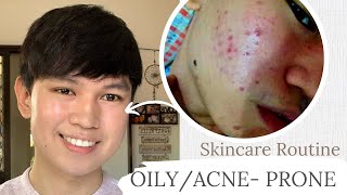 How To Skincare for Oily amp Acne Prone Skin  2022 Philippines [upl. by Ailuj]