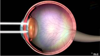 Structure and Working of Human Eye [upl. by Dorfman]