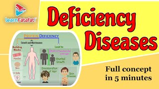 Deficiency Diseases Class 6 Chapter 2 Components of food  CBSE  LearnFatafat [upl. by Ilyk]