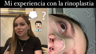 PREGUNTAS SOBRE MI RINOPLASTIA [upl. by Ariew]