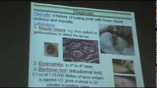 DrAzza Parasitology  Nematodes 6  Tissue Nematodes [upl. by Yelha]