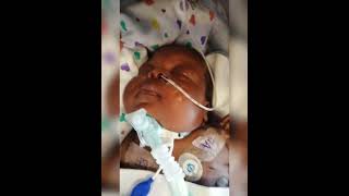 Part 7 Davina now got Tracheostomy New breathing passage trachea miraclebabies [upl. by Nikoletta763]