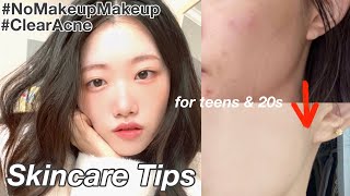 Finally Realized Top skincare tips for teens amp 20s from grad student clear acne no makeup makeup [upl. by Lias923]