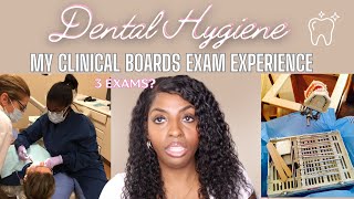 My Clinical Dental Hygiene Boards Exam Experience CDCAOSCE SinfulliAmbitiousss [upl. by Akitan115]