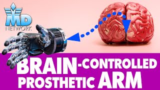 BrainControlled Prosthetic Arm How The 2Way Feedback Bionic Arm Works [upl. by Anerual]