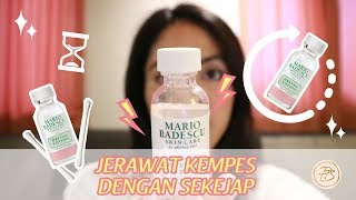 Jerawat kempes dengan sekejap I Review Mario Badescu Drying Lotion l Skincare [upl. by Letnuahc278]