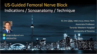 Ultrasoundguided Femoral Nerve Block [upl. by Elie272]