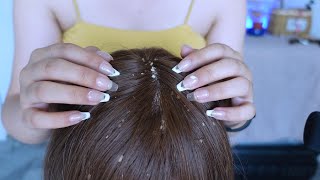 ASMR  Dandruff Removal amp Scalp Check Extremely Satisfying [upl. by Margot]