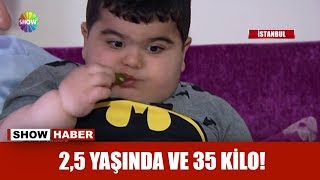 25 yaşında ve 35 kilo [upl. by Thurman]