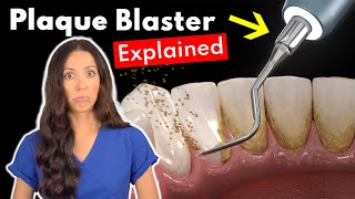 Dental Hygienist Explains Ultrasonic Scaling  Teeth Cleaning With Plaque Blaster [upl. by Sidnac]