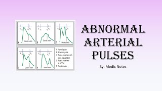 Types of arterial pulses  anacrotic bigeminal dicrotic pulsus alternans pulsus parvus et tardus [upl. by Kwapong524]