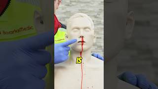 How to stop nose bleeding nosebleeding blood emergency [upl. by Schonfield]