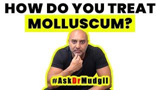 HOW DO YOU TREAT MOLLUSCUM [upl. by Aloivaf]