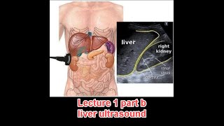 Abdominal ultrasound course  lecture 1 part b  liver د عمرو صلاح [upl. by Giraud414]