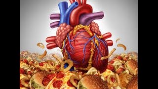 An Easy Natural Way To Unclog Your Arteries [upl. by Diraf]