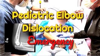 Pediatric Elbow Dislocation How to Recognize and Treat [upl. by Caspar]