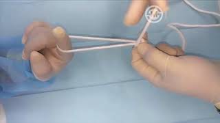 Simple and Safe Extracorporeal Knotting Technique for Laparoscopic Appendectomy [upl. by Mcquoid]