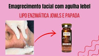 Lipo Enzimática Facial e Papada  Emagrecimento facial [upl. by Nnahtebazile]