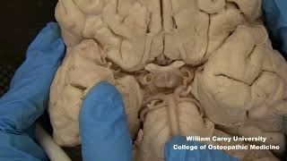 Ventral brainstemhypothalamus neuroanatomy hypothalamus brainstem anatomymedicalstudentbrain [upl. by Skipp]