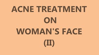 Acne Treatment on Womans Face II  Left side [upl. by Arahsak]