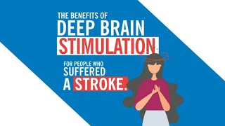 Deep Brain Stimulation is Promising for Stroke Patients Study Shows [upl. by Yoo]