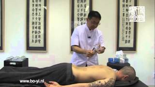 Vuur cupping advanced academie Bo Yi [upl. by Kolivas]