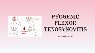 Pyogenic flexor tenosynovitis  epidemiology causes Kanavel signs imaging treatment [upl. by Gnahk87]