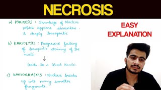 Necrosis  1  Pathology  EOMS [upl. by Winograd]