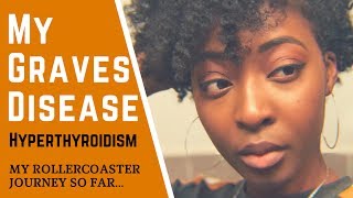 My Graves Disease Hyperthyroidism  Fear Anxiety amp Bad Doctors [upl. by Costanza]