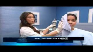 Keloid amp Hypertrophic Scar treatment using Cryoshape on quotThe Doctors TVquot [upl. by Wren]