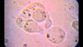 T hominis con 5 Blastocystis fagocitados intento de fagocitosis de otro y expulsión de uno [upl. by Rehpotsirhc]