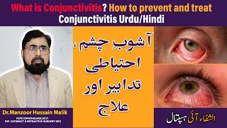 Viral and Bacterial Conjunctivitis  Urdu Hindi [upl. by Kimball]